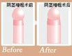 有哪些原因會導致男性陰莖短小